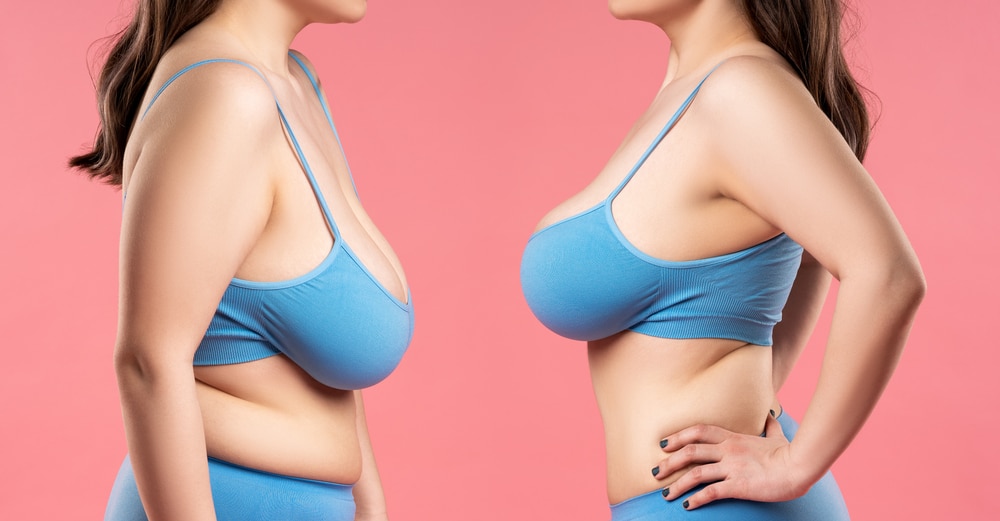 Understanding the Timeline: How Long Does Breast Reconstruction Surgery Take? | Plastic Surgery Specialists